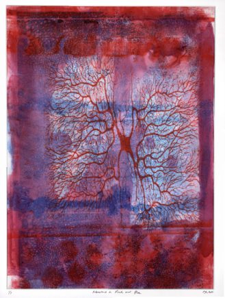 Neurons in Pink and Blue